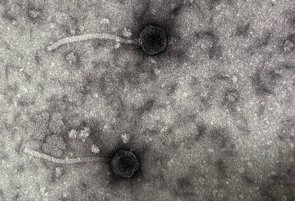 An electron micrograph of the phage isolated by Dr. Crossley.
