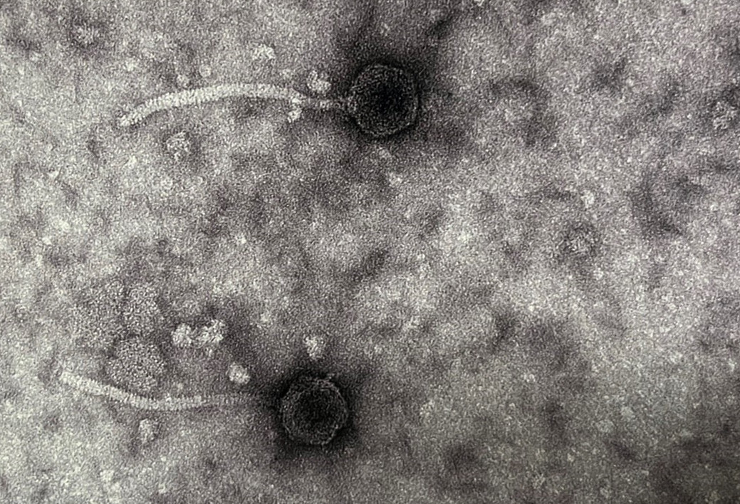 Dr. Davida Crossley Isolates Odie_Owl The Phage – Department of ...